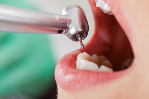 Best Emergency Denture Repair in Converse, IN